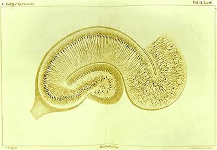This is a drawing by Camillo Golgi of a hippocampus stained using the silver nitrate method.