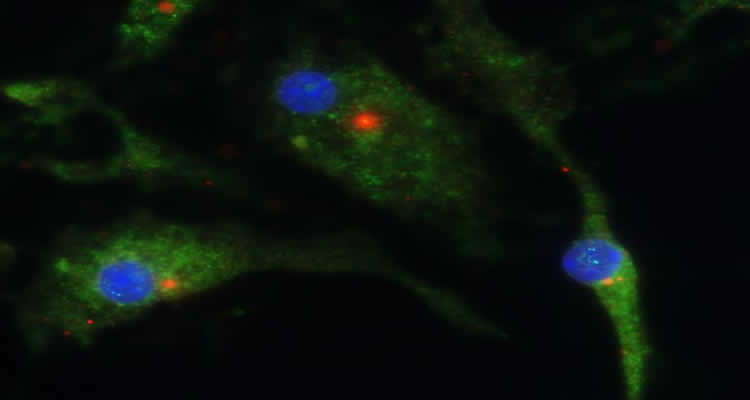 The image shows the cellular target (the red spot) for marvel molecule MCC950.