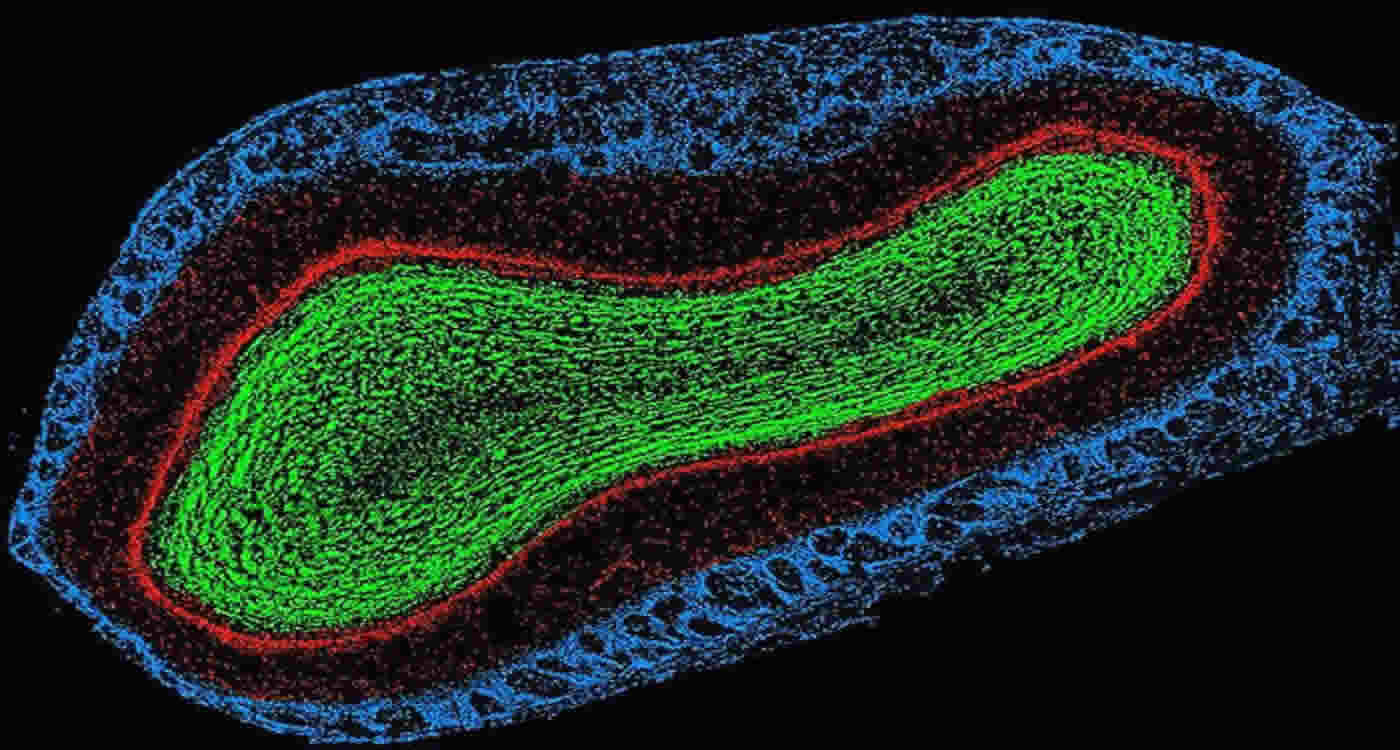 This image shows a mouse olfactory bulb.