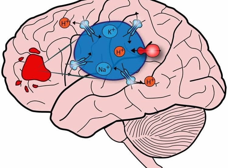 This image is a drawing of a brain. The overactive NHE9 protein is shown in blue over the brain.