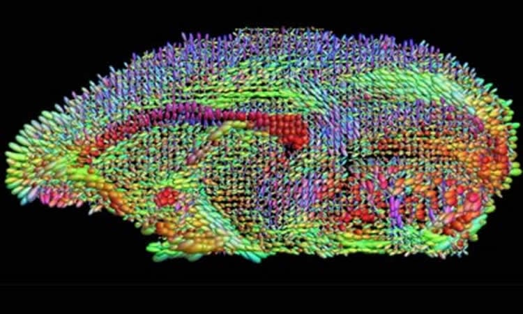 The image shows a visualization of the neural networks.