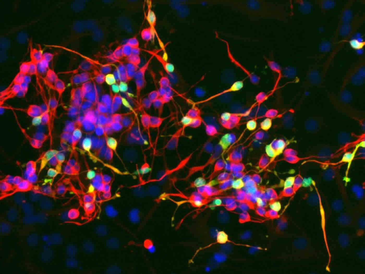 Images show a cluster of neurons.