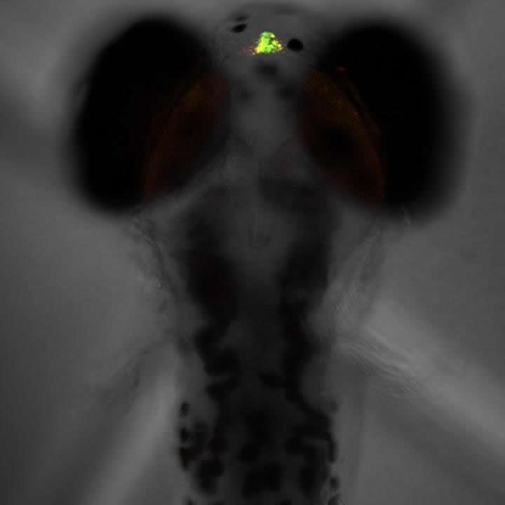 This image shows the larval zebrafish pineal gland.