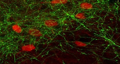 This image shows axonal fibers from basal forebrain parvalbumin GABA neurons.