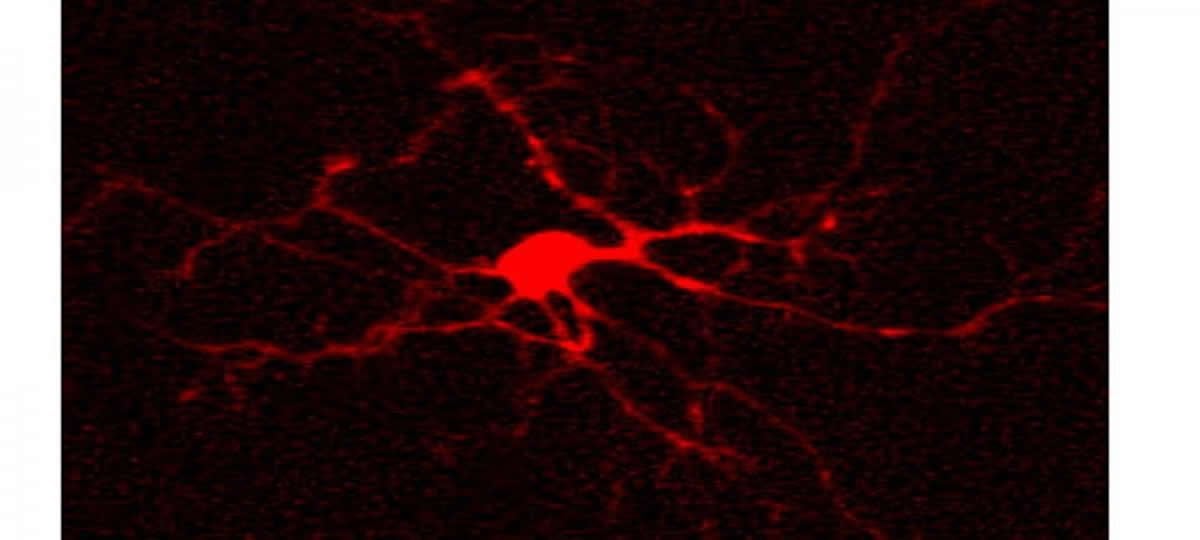 The image shows biocytin in a neuron.