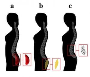 The image shows the gluteal development.