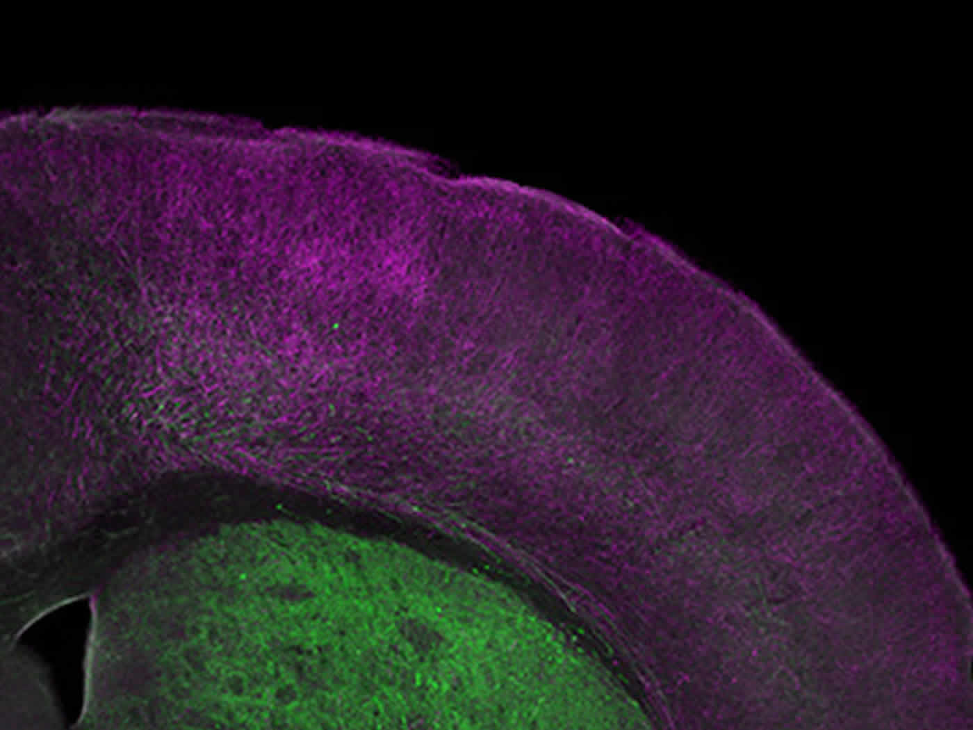 This image shows a microscopic view of the frontal cortex of a mouse.