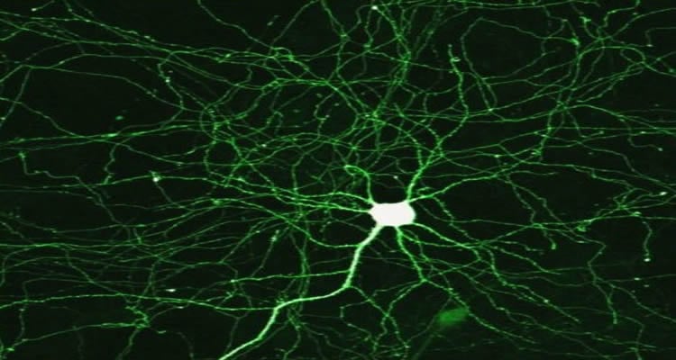 This image shows a neuron.