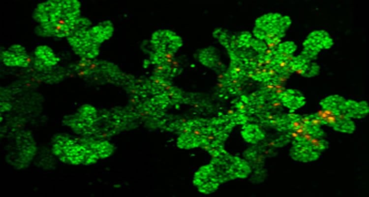 This shows the progenitor cells in green.