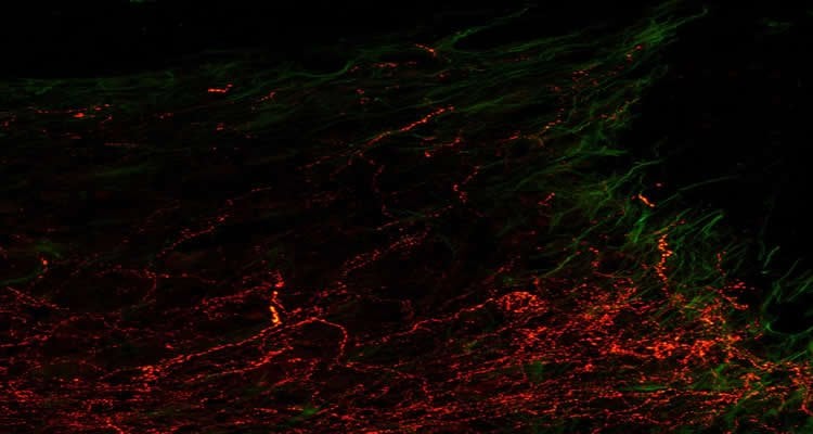 The image shows axons at the spinal cord injury site.