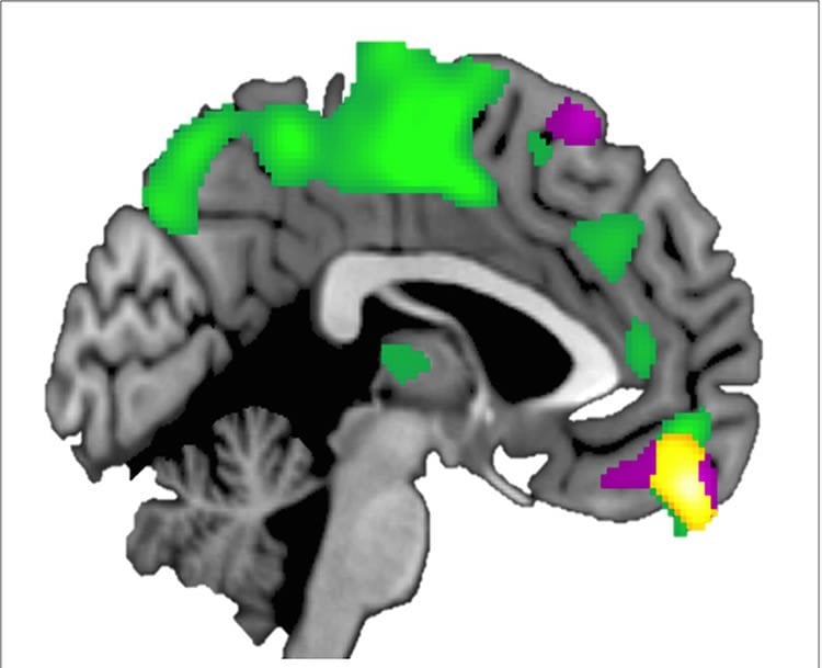 The VPC is outlined in yellow in this brain image.