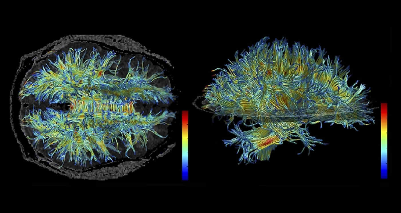 Images shows the white matter structure of the human brain.