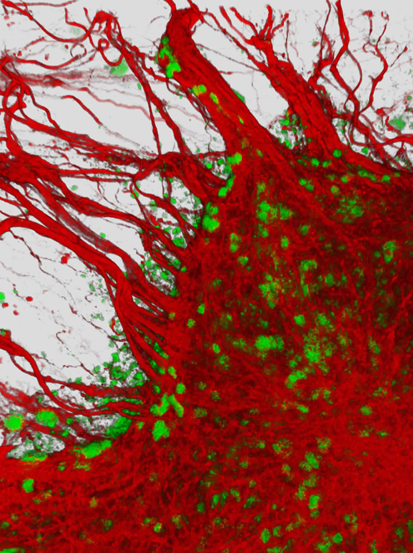 This is a 3-D image of human neurons in a dish.