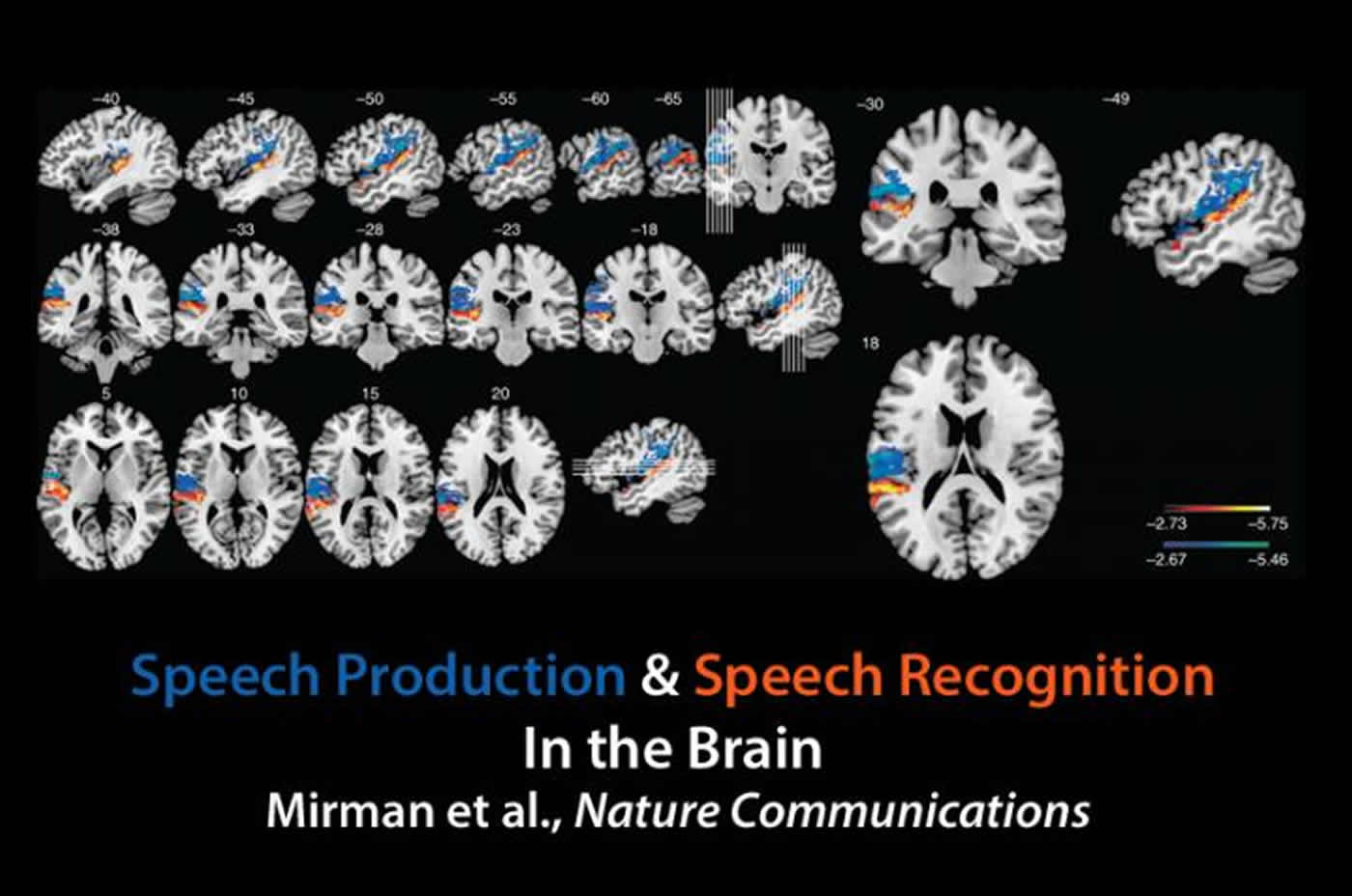 This shows the brain scans taken as part of the study. The caption best describes the image.