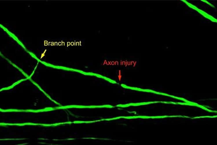 This shows injury to a spinal cord axon after a major branch point.