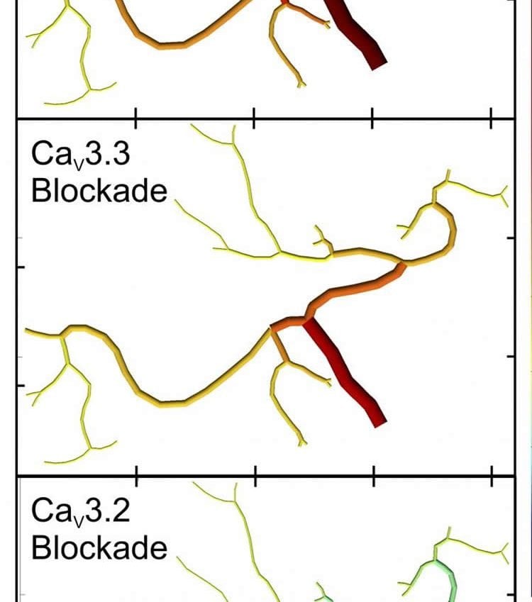 This computation model reveals that blocking CaV1.2 or CaV3.3 dilates cerebral arteries and increases blood flow, whereas blocking CaV3.2 constricts arteries and decreases cerebral blood flow.