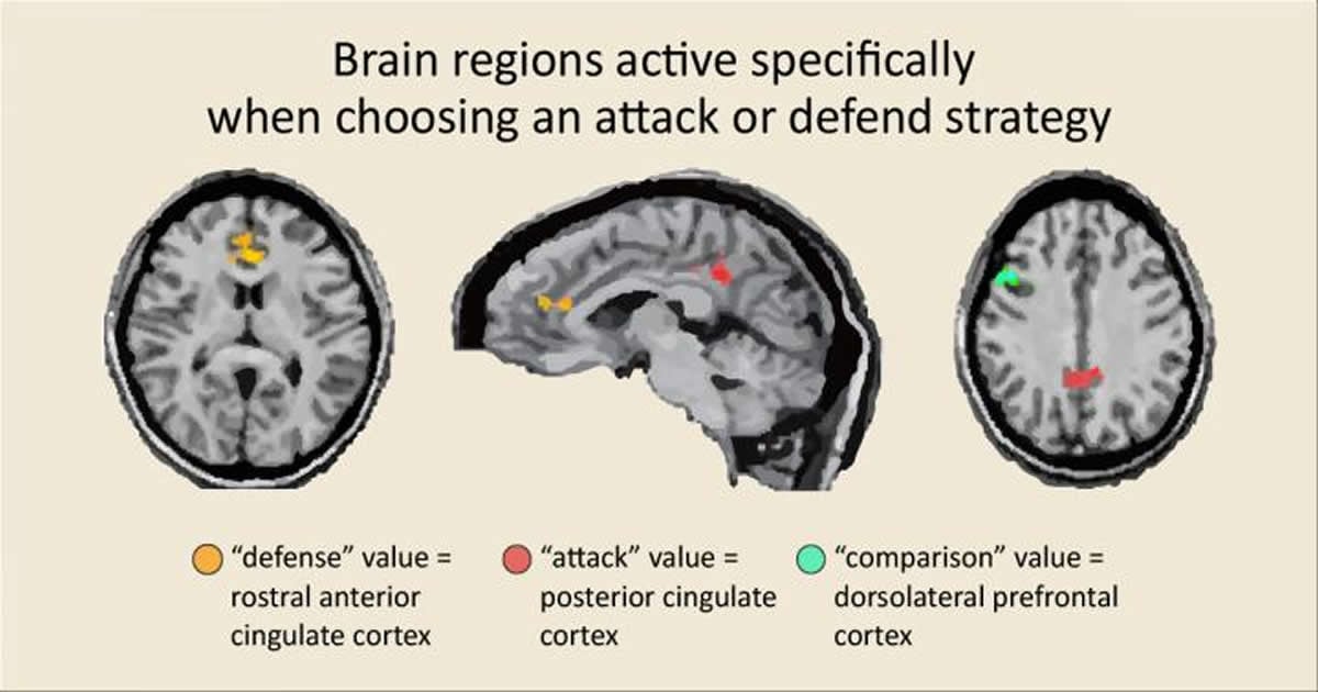 Anterior Cingulate Cortex