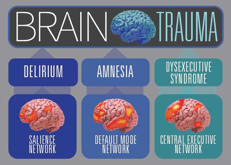 This shows how different areas of the brain are affected by tbi.