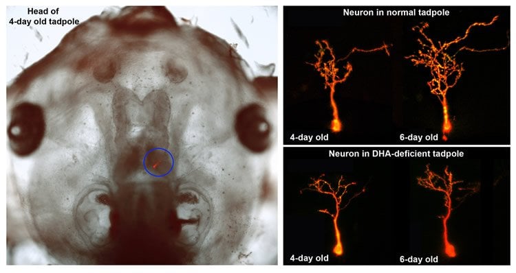 This shows a tadpole head and neurons.