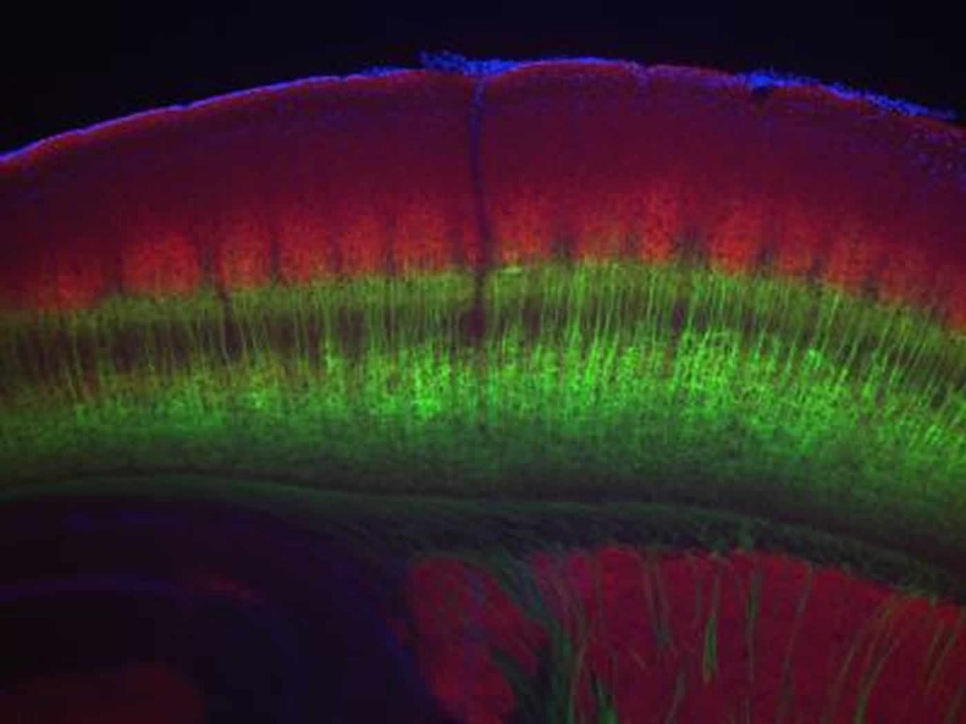 This shows a stained slice of the neocortex.