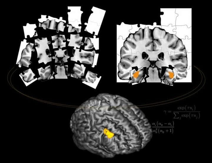 This shows brain scans taken from the study. One of the scans is broken down into jigsaw pieces.