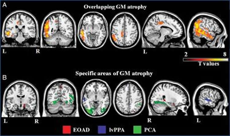 This image shows MRI scans from the research paper.