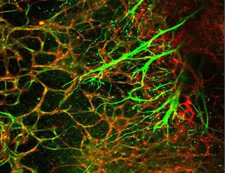 This shows the autonomic neurons (green) co-patterning with blood vessels (red).