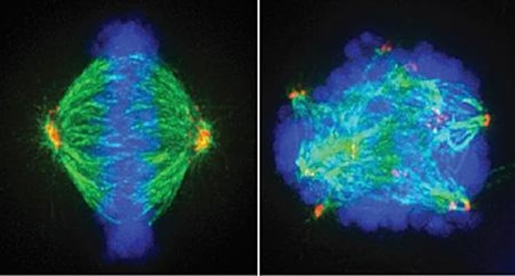 This image showsn normal cell dividing (left) and stressed cancer cell dividing (right). PLK1 inhibitors stress cancer cells, making them easier to kill.