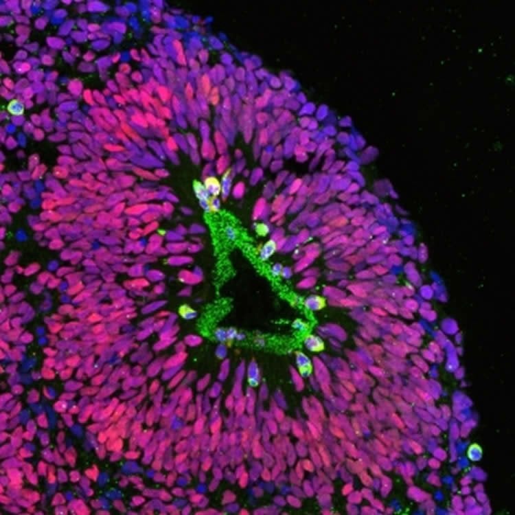 This image shows a cross section of a human cortical spheroid shows dividing neural progenitor cells.