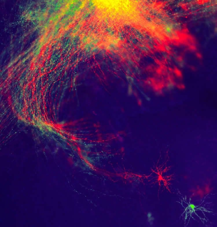 This shows neurons in the thalaums of a mouse.