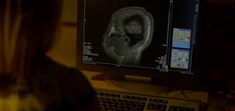 This image shows a researcher looking at a brain scan on a computer monitor.