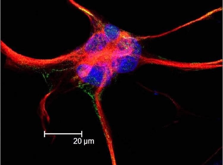 This is an astrocyte, labeled with GFAP (red), Focal Adhesion Kinase (FAK) green, and nuclear stain To-Pro (blue).
