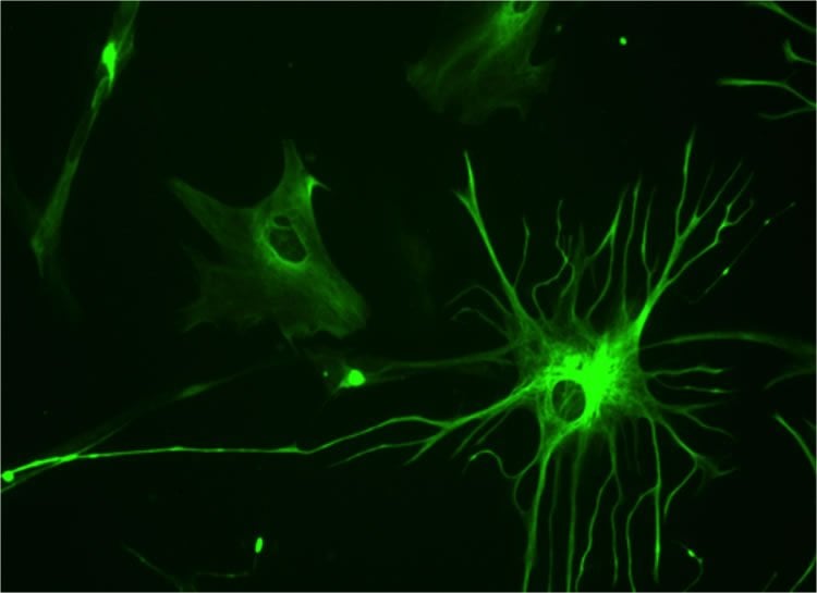 Image shows 23 week human culture astrocyte stained for GFAP.