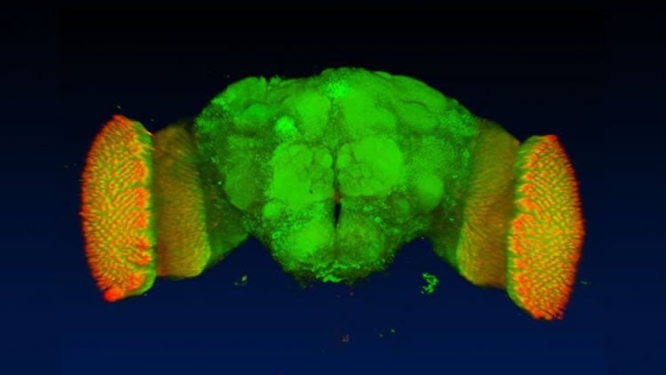 This image shows the brain of a fruit fly.