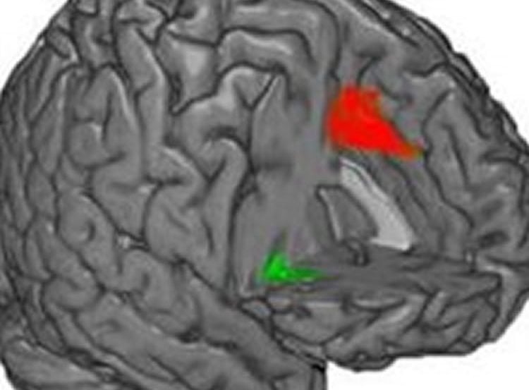 This image shows a brain with the insula highlighted.