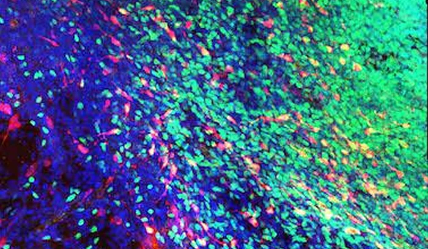 This image shows the interneurons migrating to the striatum.