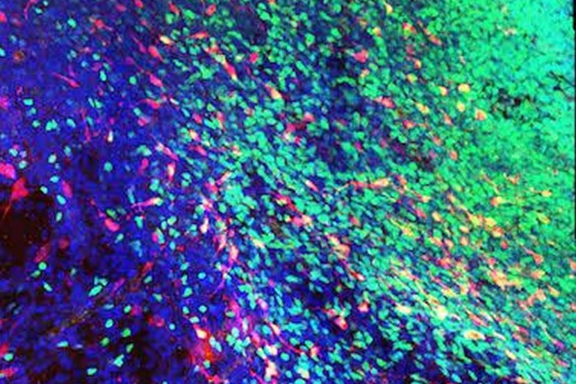 This image shows the interneurons migrating to the striatum.