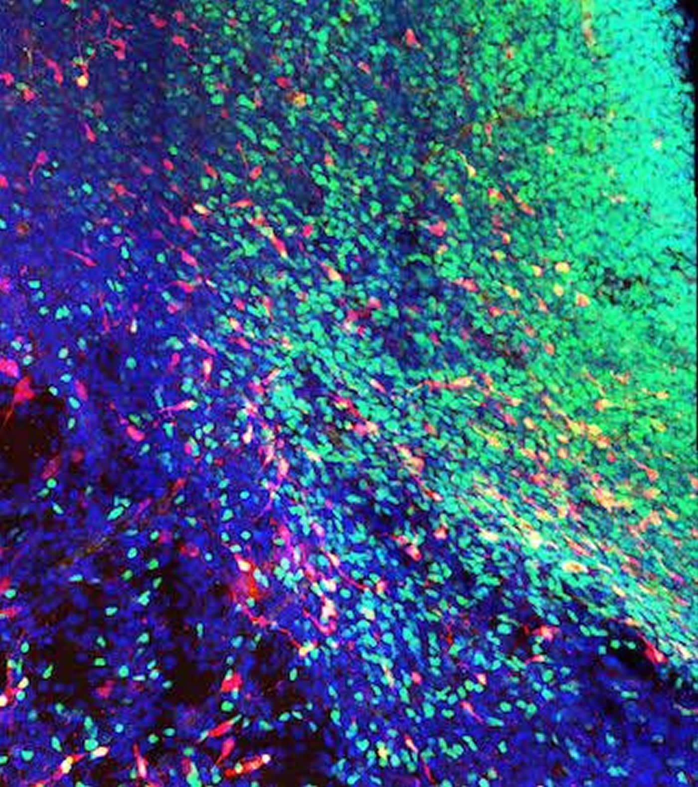 This image shows the interneurons migrating to the striatum.