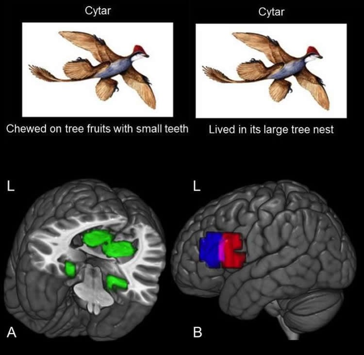 Image shows brain scans attributed to the study.