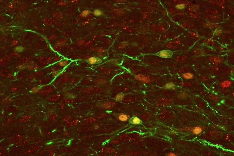 This image shows neurons in the nucleus accumbens.