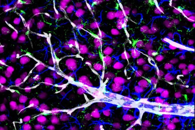 This image is a snapshot of a neurovascular unit, consisting of neurons (pink), astrocytes (blue), resident microglia (green), a penetrating arteriole and capillaries (white).