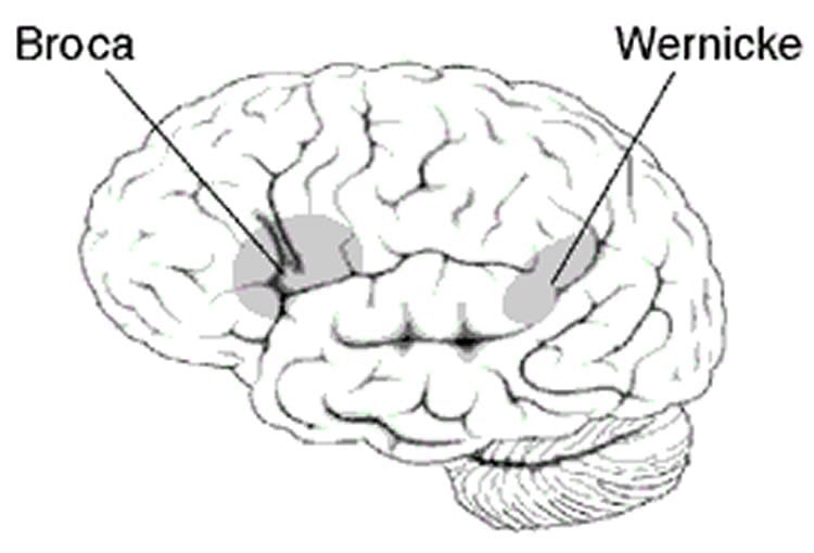 This image shows the location of the Wernicke's area in the brain.
