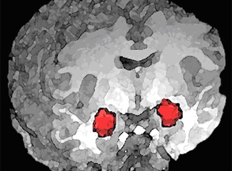 This image shows the location of the amygdala in the brain.