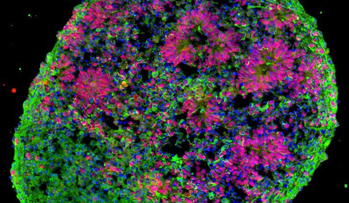 This image shows stem cell derived mini forebrains.