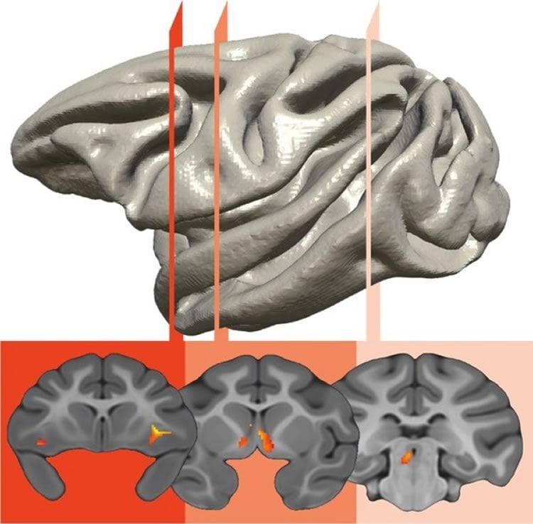 This image shows a prefrontal-limbic-midbrain circuit is responsible for the genetic transfer of an anxious temperament.