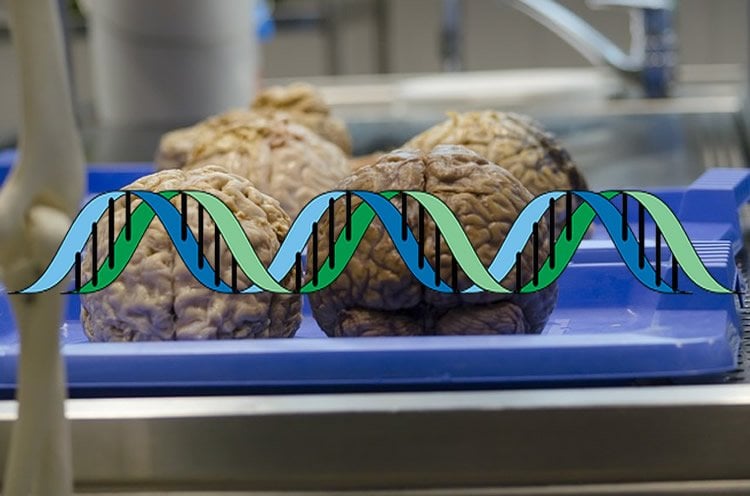 This image shows four brains on a surgical tray.