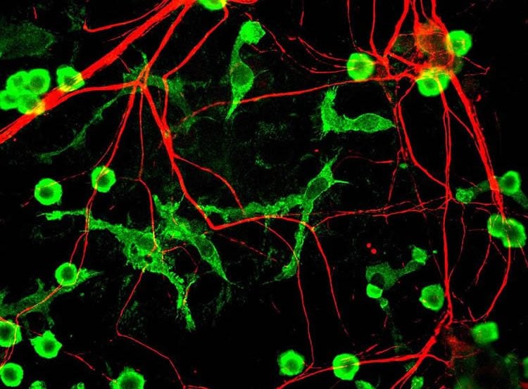 This image shows mixed rat brain cultures stained for coronin 1a, found only in microglia and here in green, and alpha-internexin, in red, found in neuronal processes.