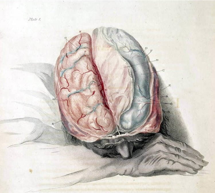 This image shows a man sleeping with his brain exposed.