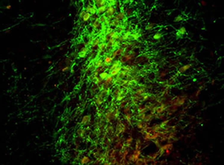 This image shows mouse neurons.