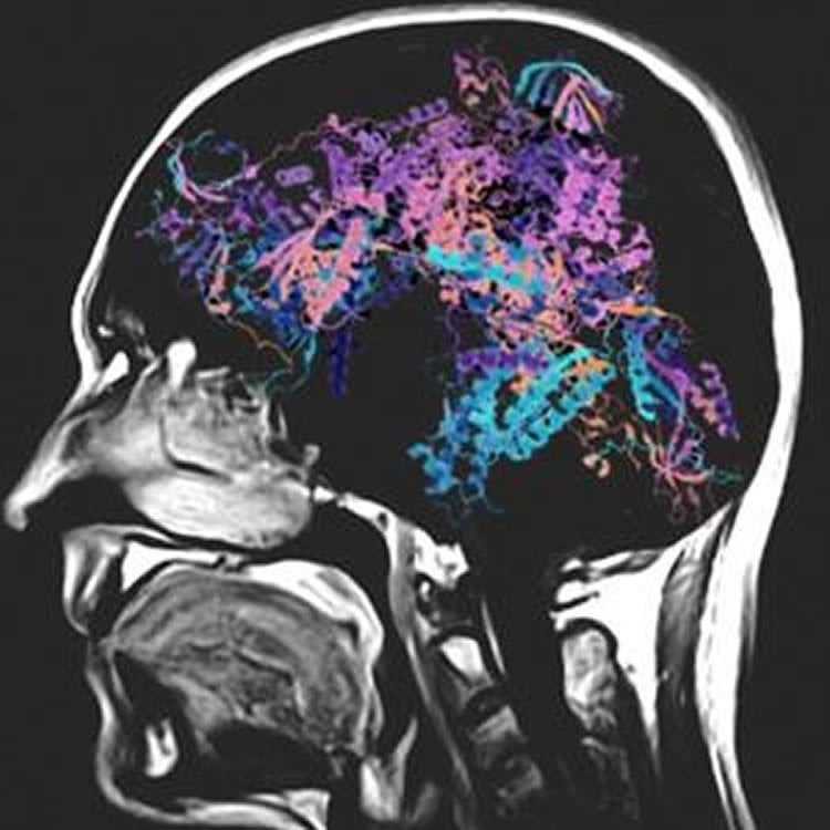 This image shows an NMR scan of a human head.